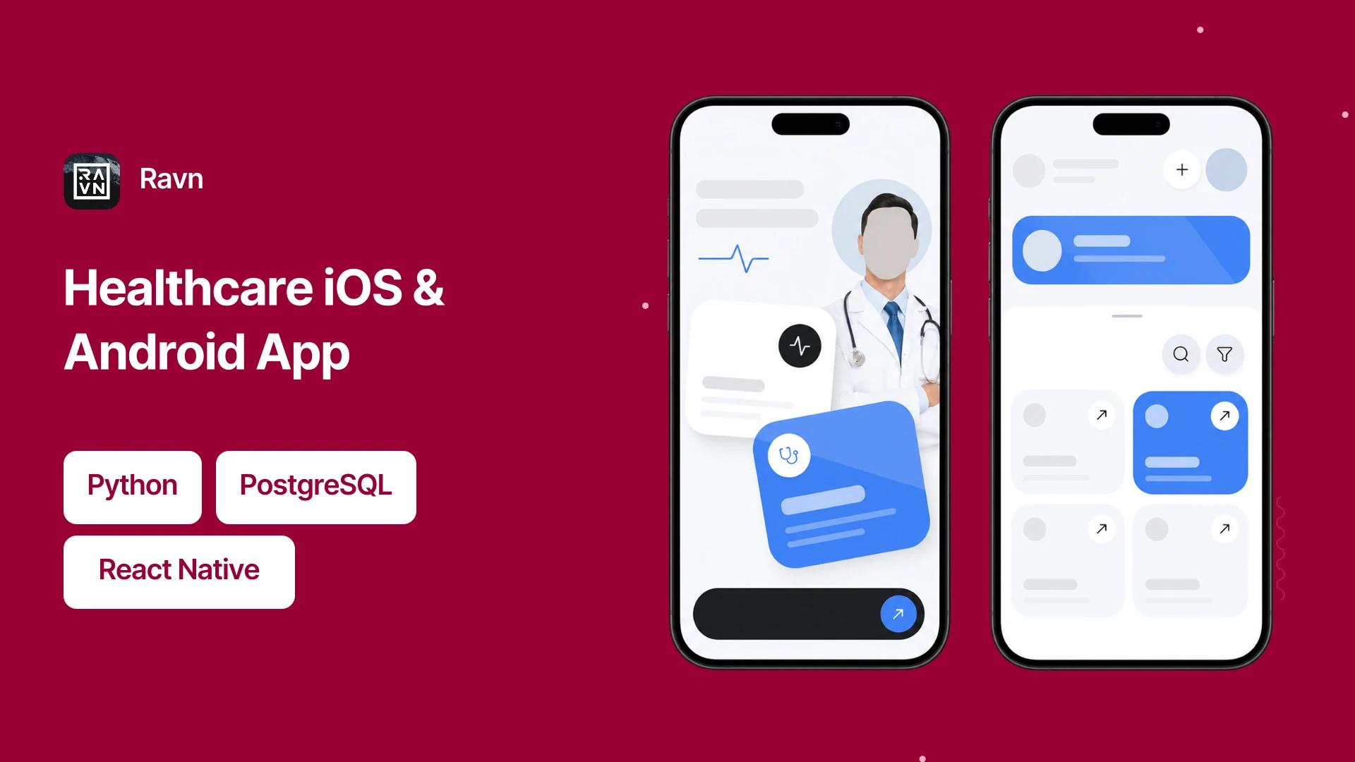 Project hero — replace with case study imagery