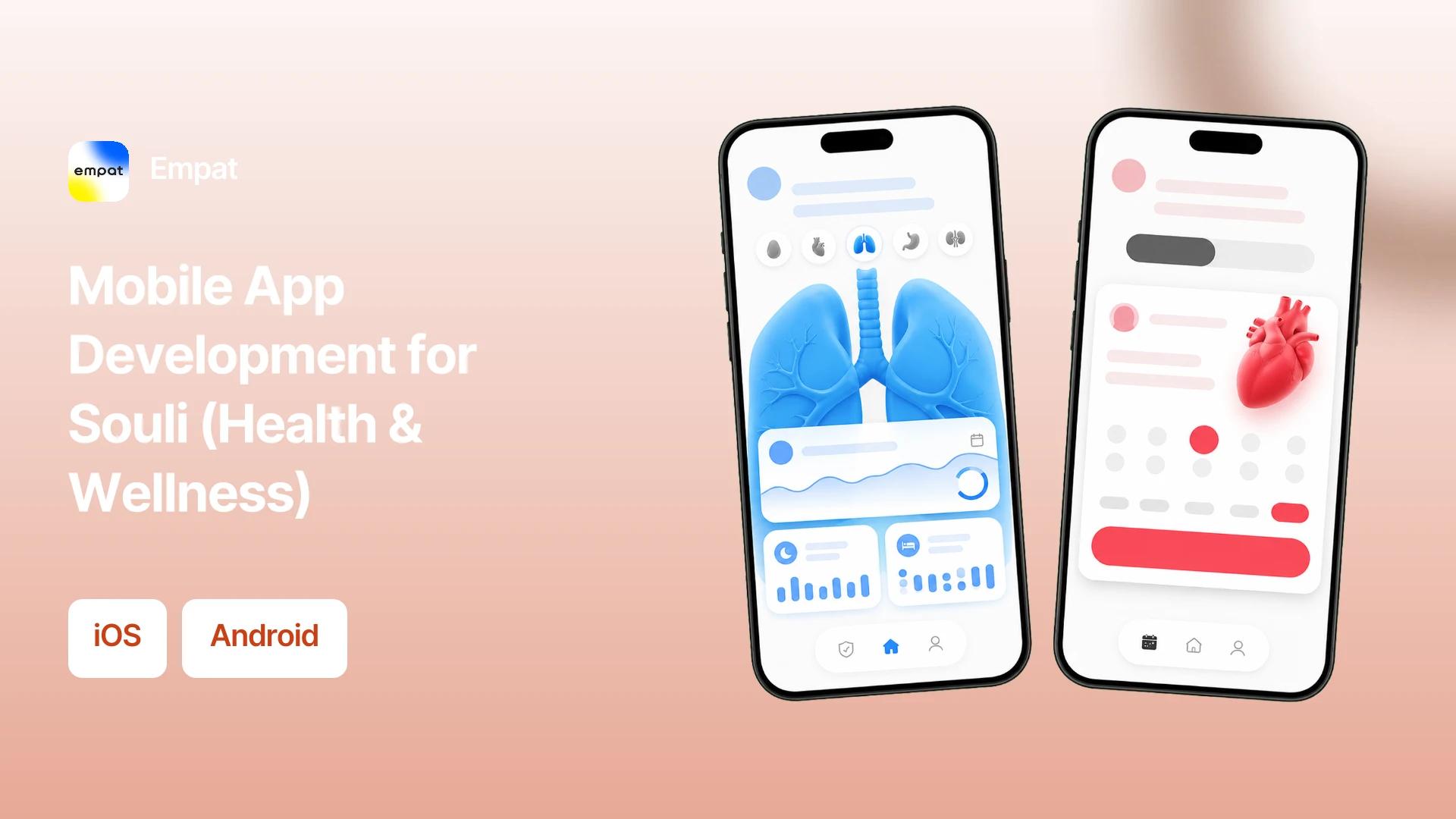 Project hero — replace with case study imagery